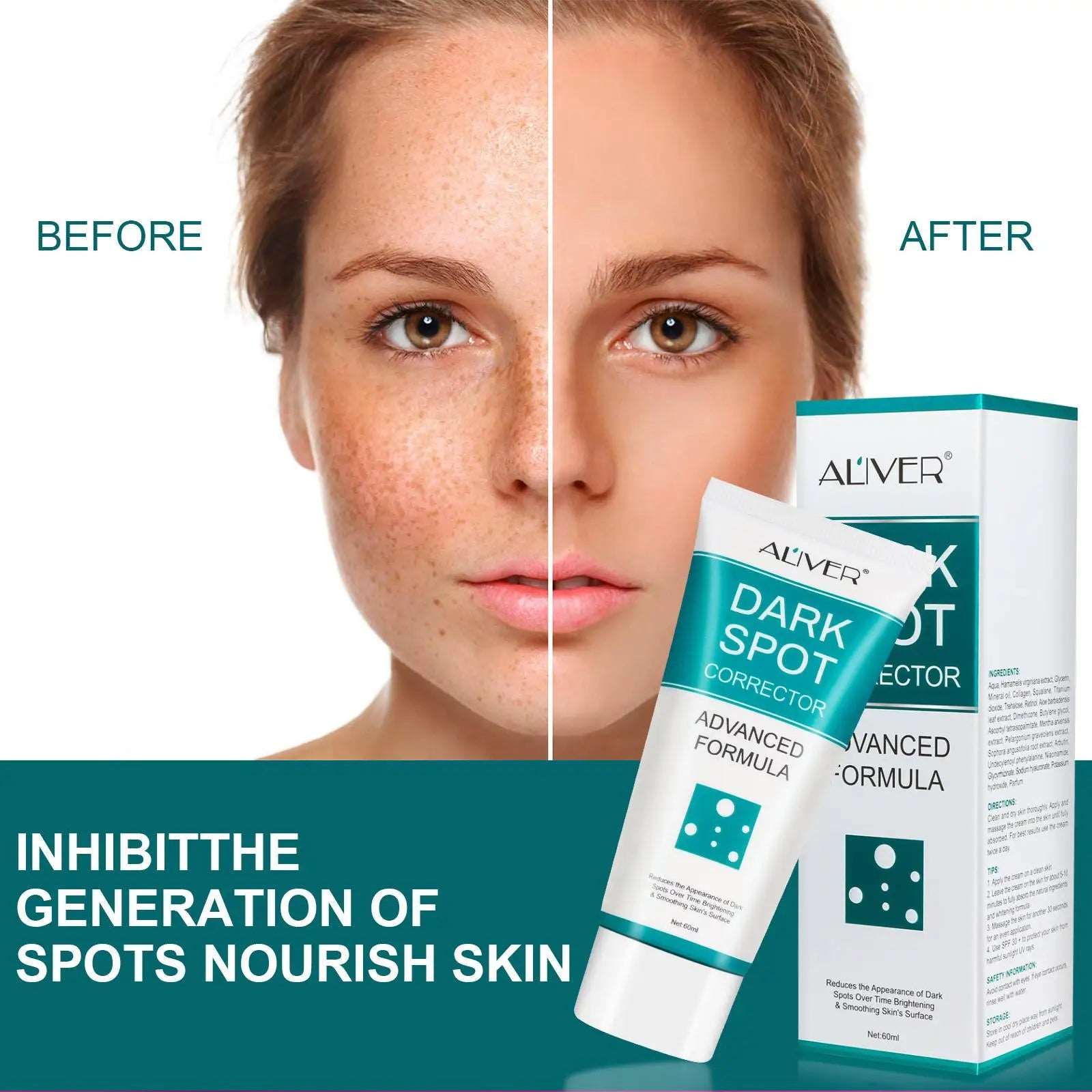 20/60Ml Whitening Freckle Cream Face Moisturizer Remove Dark Spots Melasma Remover Brightening Skin Repair Anti-Aging