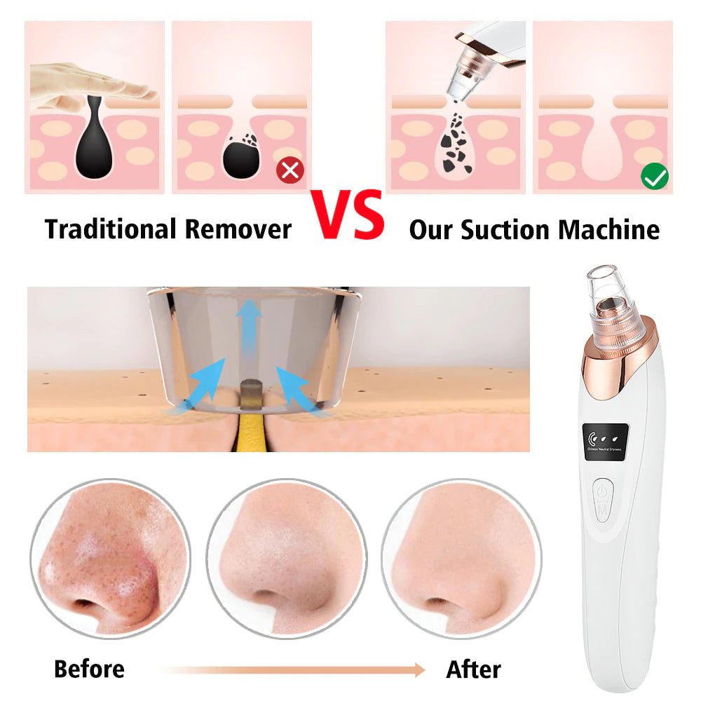 Beauty Electric Blackhead Remover Facial Cleaner Black Point Vacuum Suction Black Head Dots Remover Extractor Skin Care Tools