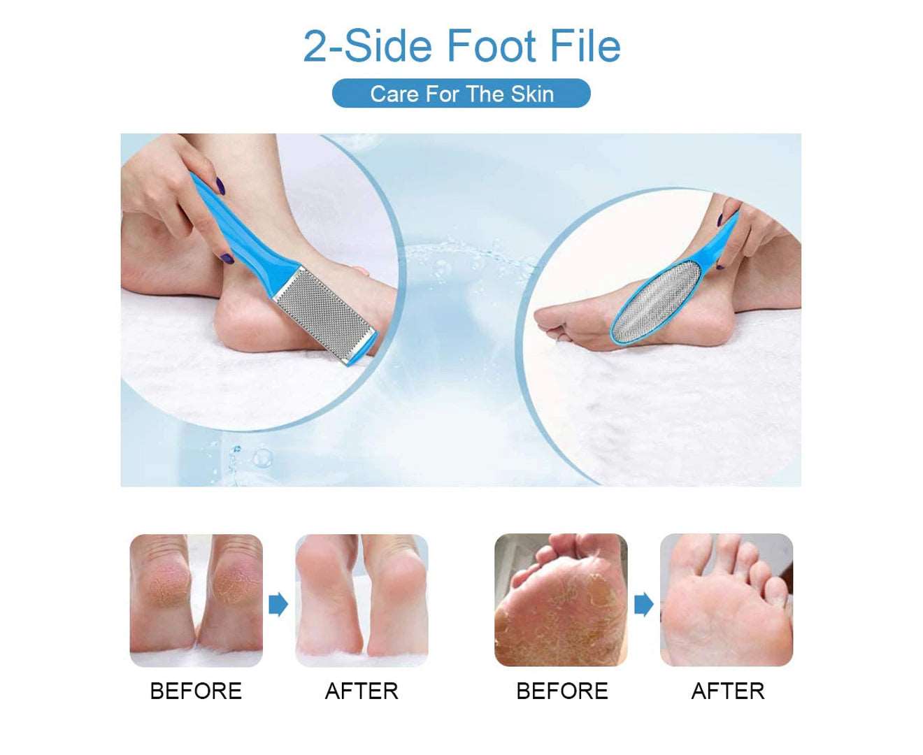 Feet Rasp Files,Foot Files for Callus Remover,Pedicure Tool Set