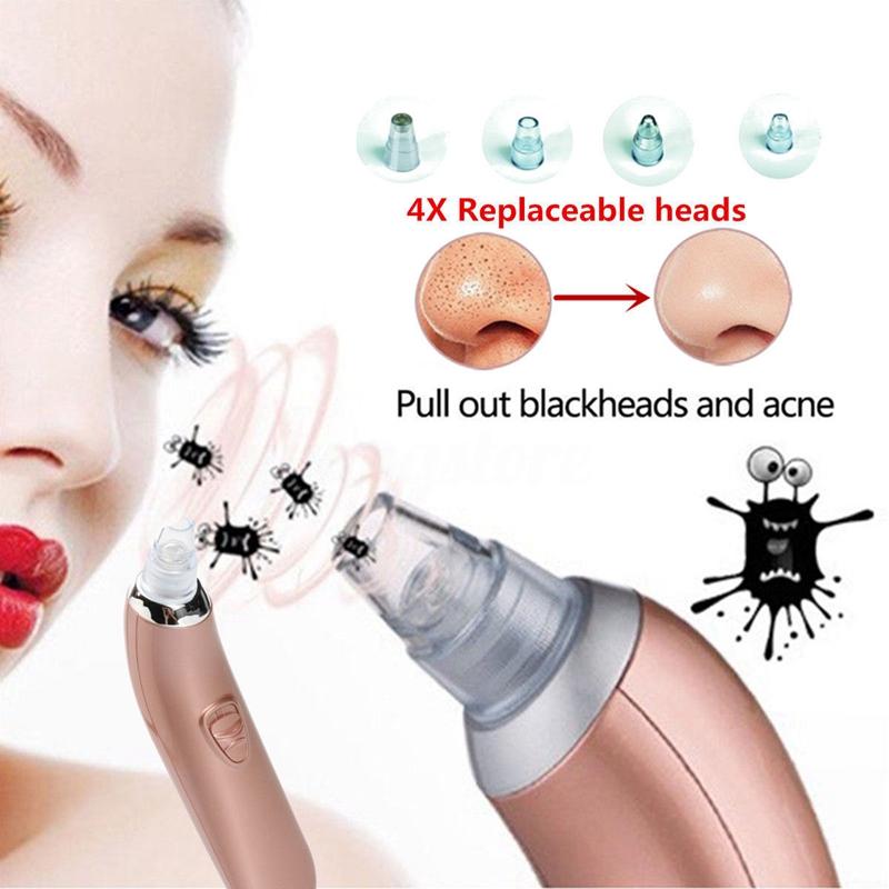 Electric Facial Face Acne Pore Cleanser Blackhead Remover Vacuum