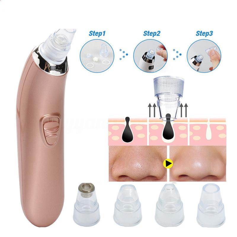 Electric Facial Face Acne Pore Cleanser Blackhead Remover Vacuum