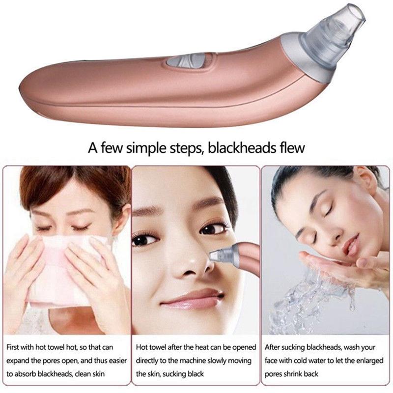 Electric Facial Face Acne Pore Cleanser Blackhead Remover Vacuum